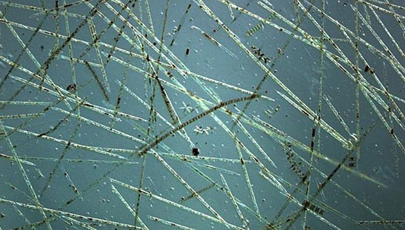 Rhizosolenia hebetata f. semispina | © Koninklijk NIOZ, www.nioz.nl
